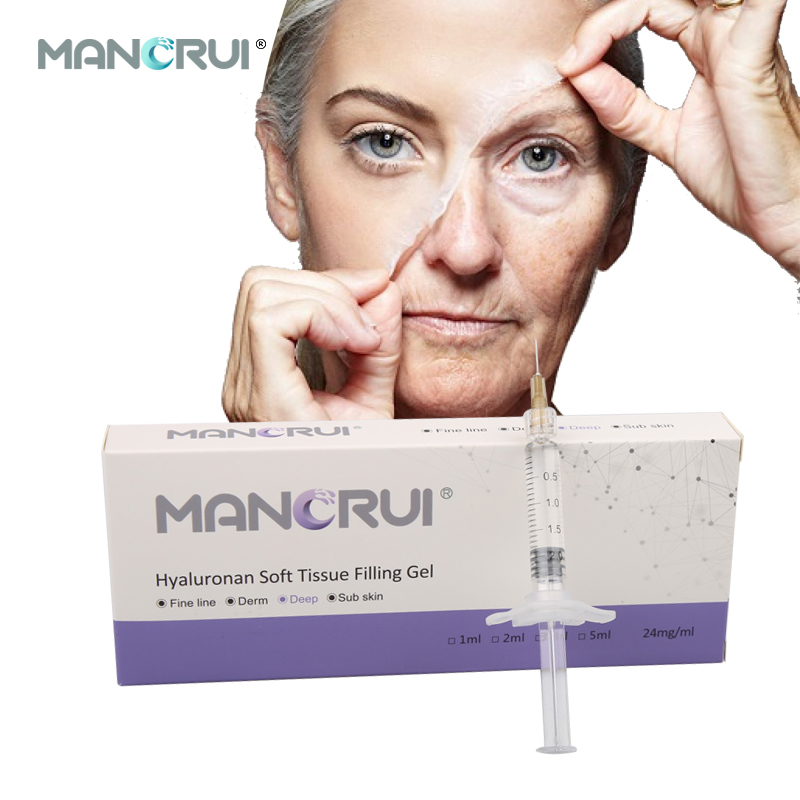 Deep 2ml for Deep wrinkles and lines, Nasolabial folds, Marionette lines, Forehead wrinkles, Chin contour, Nose shape