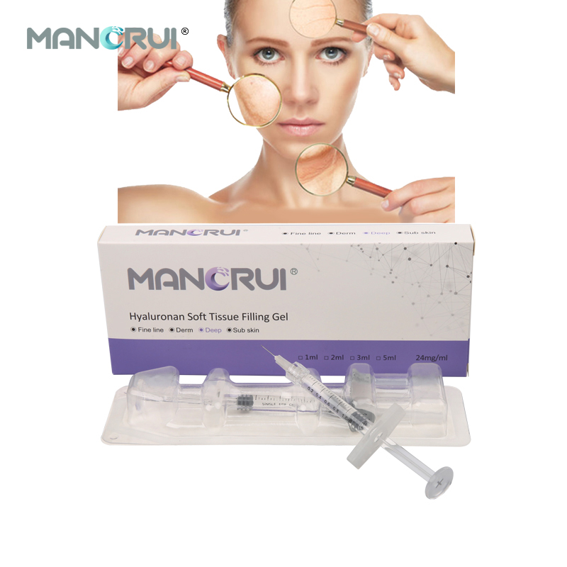 Deep 1ml Cross Linked Hyaluronic Acid Filler for Nose Shape, Chin Contour & Wrinkle Removal – Nasolabial, Marionette, Forehead Lines, Structural volume loss lines