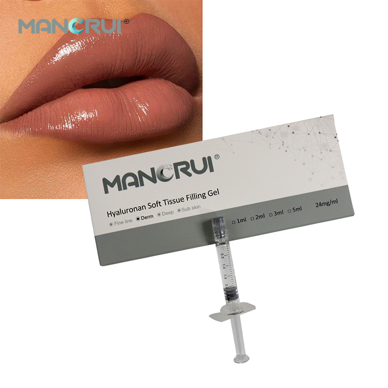 Derm 2ml Lip Filler — Natural Lip Plumping, Marionette Line & Frown Line Correction, Mid-Depth Smile Line Treatment