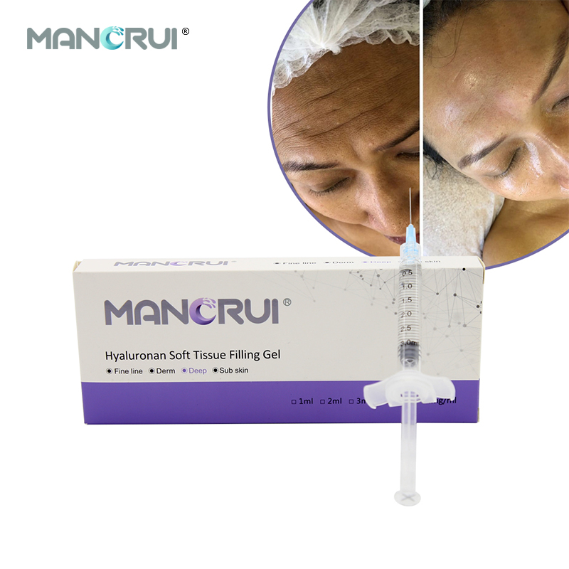 Deep 3ml Cross Linked hyaluronic acid filler for Deep wrinkles and lines ,Nasolabial folds, Marionette lines, Forehead wrinkles, Chin contour, Nose shape（Certified by CE and FDA.）