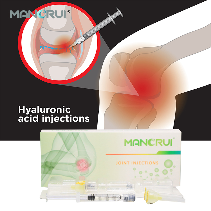 New products 3ml Non-crosslinked hyaluronic acid knee joint injection for osteoarthritis（Certified by CE and FDA.）