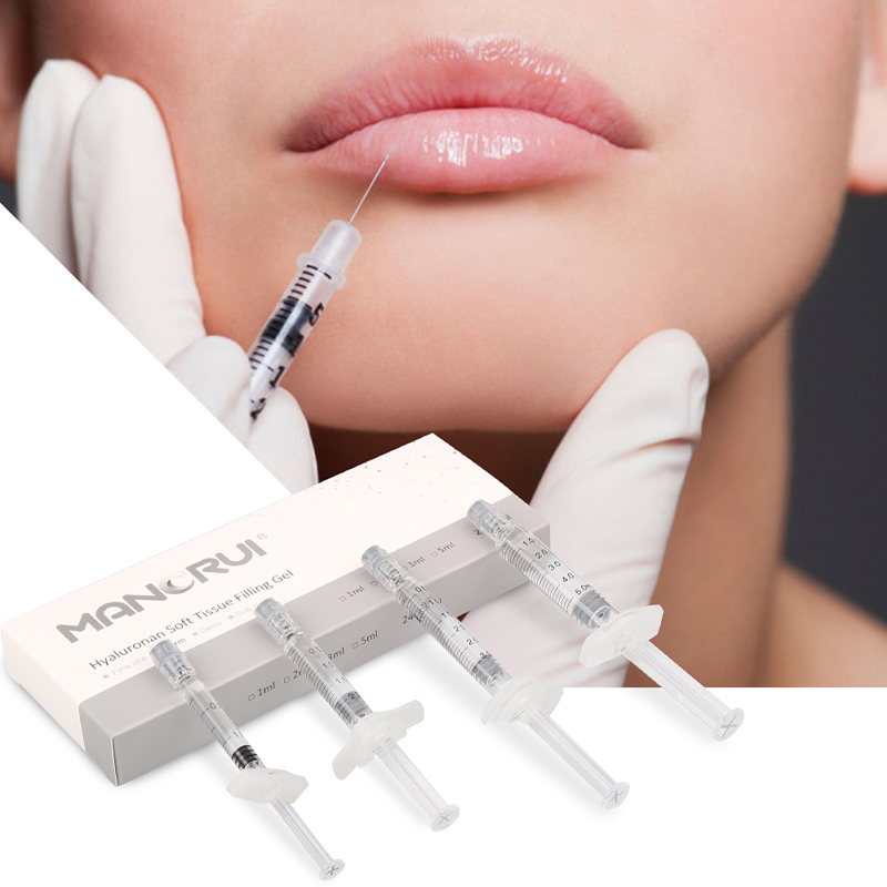 Derm 2ml Lip Filler — Natural Lip Plumping, Marionette Line & Frown Line Correction, Mid-Depth Smile Line Treatment